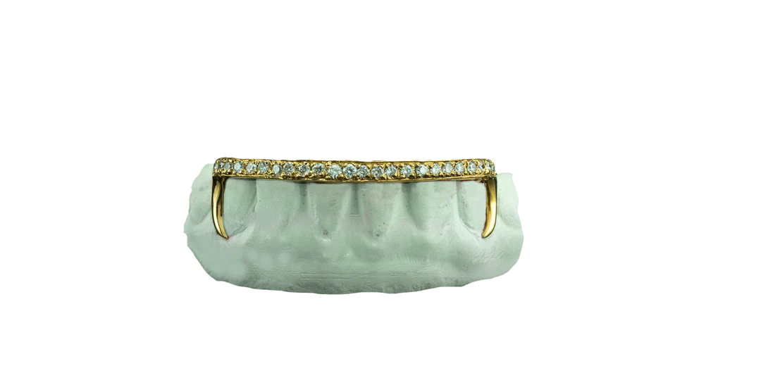 14K bottom bridge gold grillz with diamonds