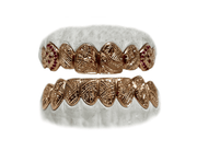 Rose gold grillz with custom hand engraving – angled