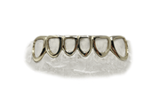 Bottom 6 open face yellow gold grillz close-up - Luxe Grillz