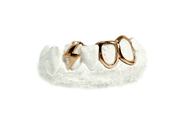 Bottom Lightning Grillz Rose Gold Front View – Luxe Grillz