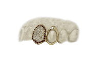 Diamond Fang with Ruby Halo and Open Face Gold Fang – Luxe Grillz