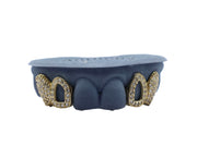 Diamond fang grillz with open face design – straight-on view