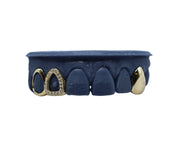 Diamond Open Face Grillz w Gold Open Face + Single Fang