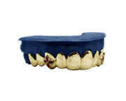 Top 10 Grillz w Marquise Ruby and Diamond Fangs