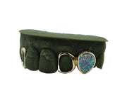 Luxe Grillz photo – custom top grillz with polished finish