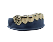 Close-up photo of Luxe Grillz teeth with diamond accents and custom design