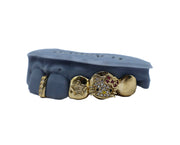 Close-up photo of Luxe Grillz custom diamond and gold teeth