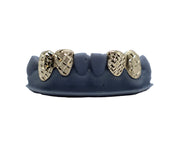Close-up of gold grillz in mouth with high-polish finish 180x – Luxe Grillz