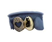 Diamond dust gold grillz top row – model lifestyle shot with hand detail