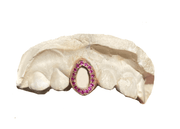 Single open face rose gold grillz with magenta sapphire – profile view
