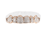 Top 8 Invisible Set Diamond Grillz in Rose Gold – Luxe Grillz
