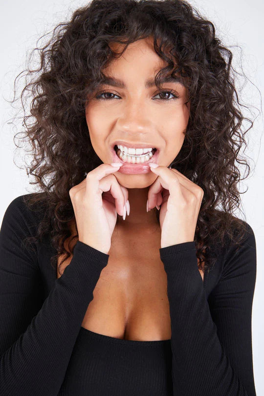 What Are Bridge Grillz?