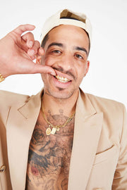 Open face grillz close-up – custom gold teeth design