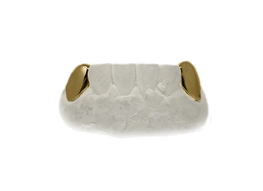 Go Bold With Gold at Luxe Grillz