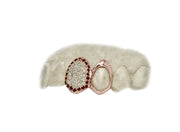 Close-up of rose gold top grillz with diamonds