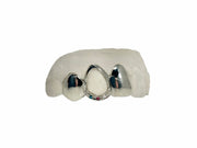 Luxe Grillz photo – top grillz with bold gold teeth style