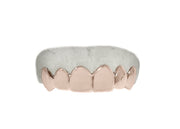 Rose gold top 6 grillz with clean polished surface