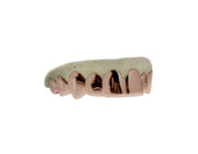 Top 10 rose gold grillz – luxury custom teeth design