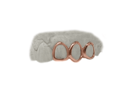 Top 3 Open Face Grillz in 14K Rose Gold