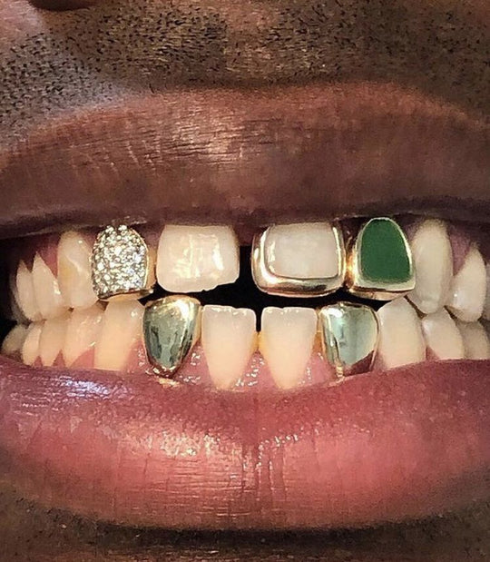 Tyler the Creator Grillz - Complete Guide on Cost and Designs
