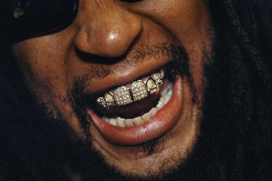 Lil Jon Custom Grillz - Complete Guide on Cost and Designs