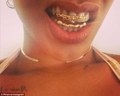 Nicki Minaj Grillz - Complete Guide on Cost and Designs