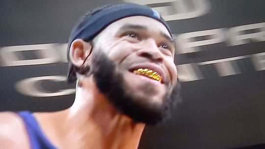 Javale McGee Grillz