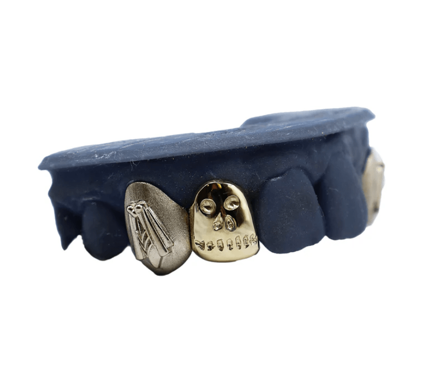 Diamond Dust Grillz