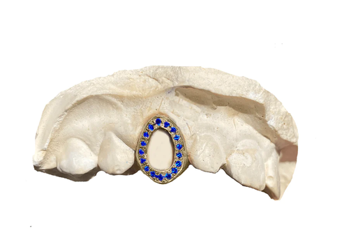 yellow gold grillz with blue sapphires