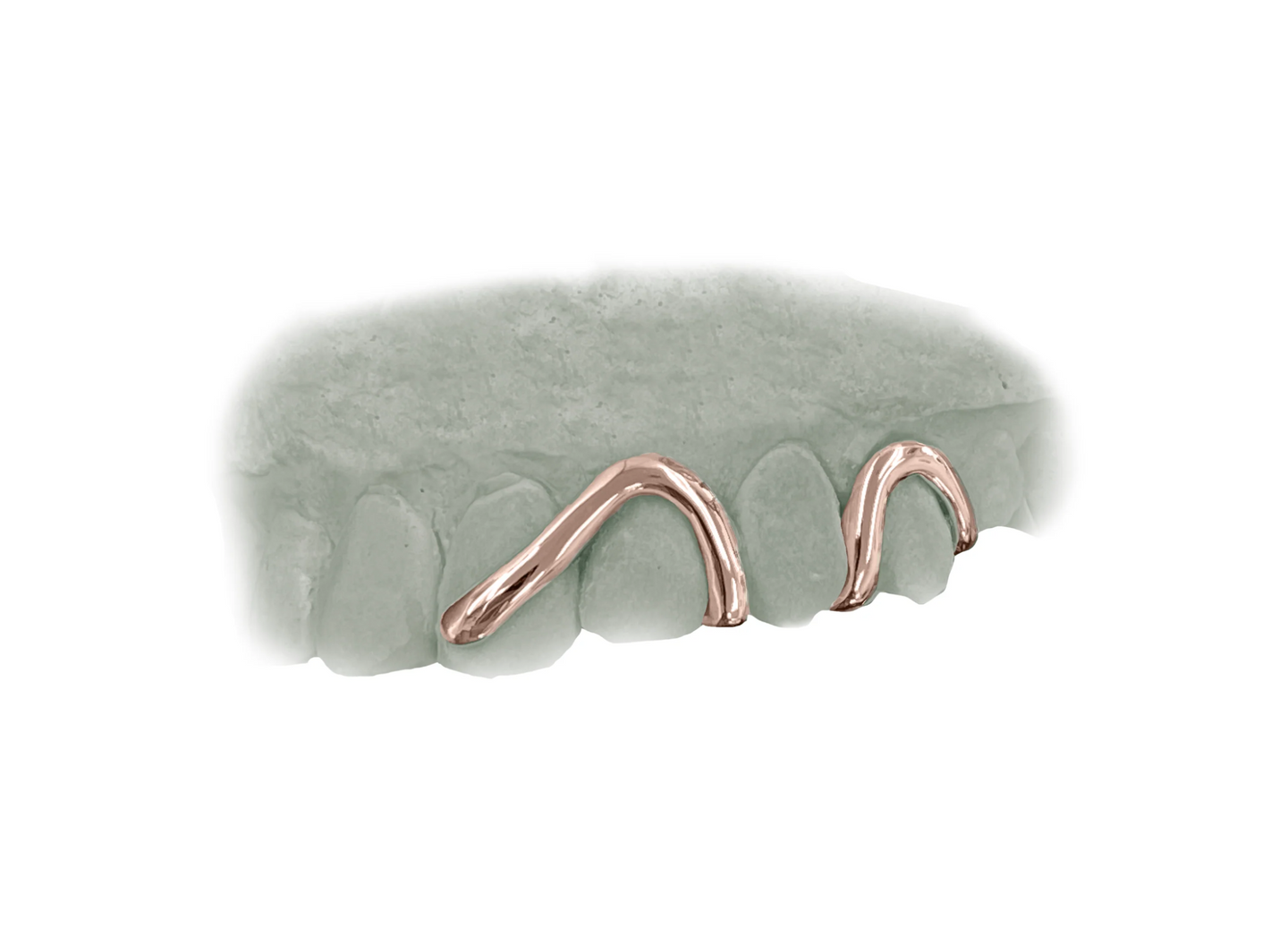 Top 4 Wave Grillz Rose Gold