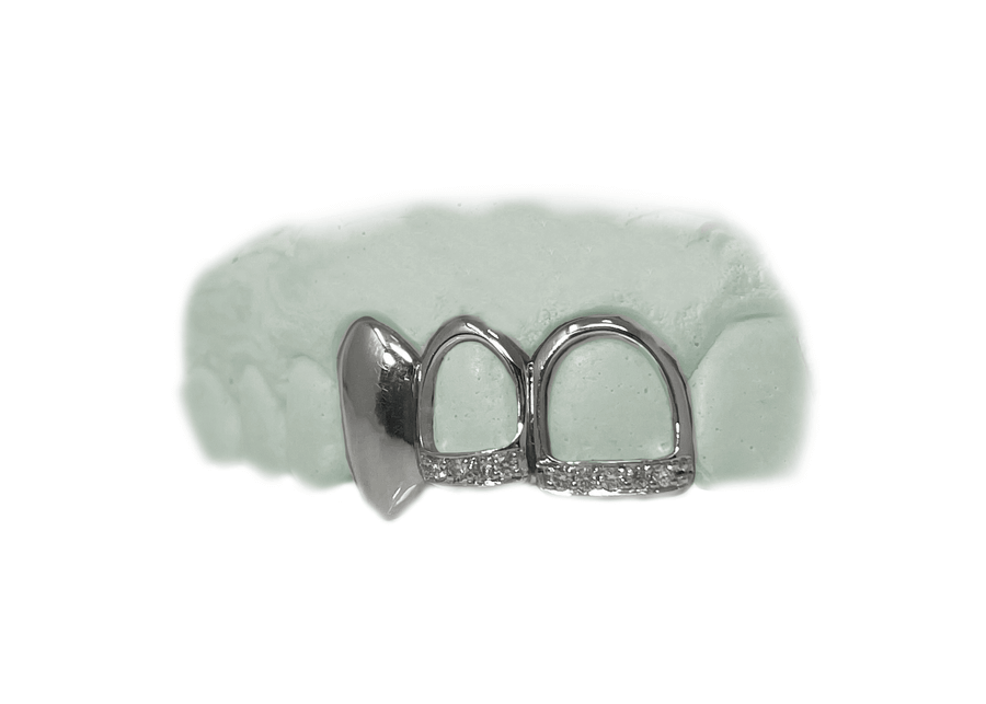 2 Teeth Open Face Teeth w Diamond Tips & Solid Gold Fang Grillz