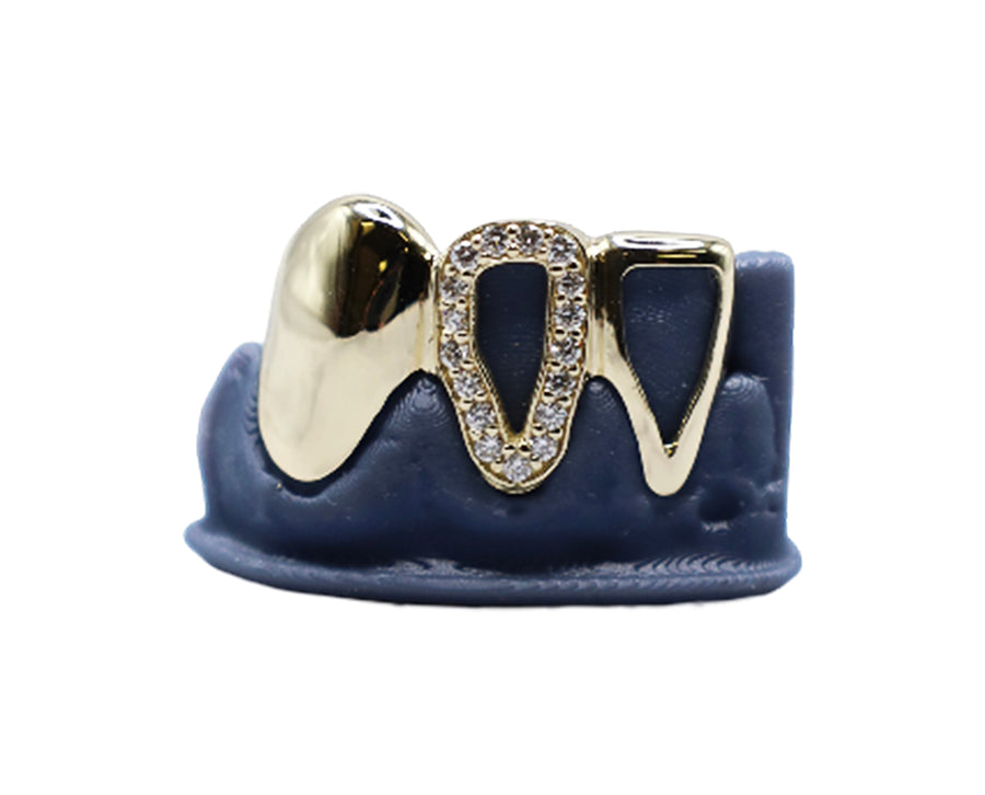 3 Tooth Grillz w Diamond Open Face, Gold Open Face and Solid Fang