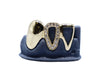 3 Tooth Grillz w Diamond Open Face, Gold Open Face and Solid Fang