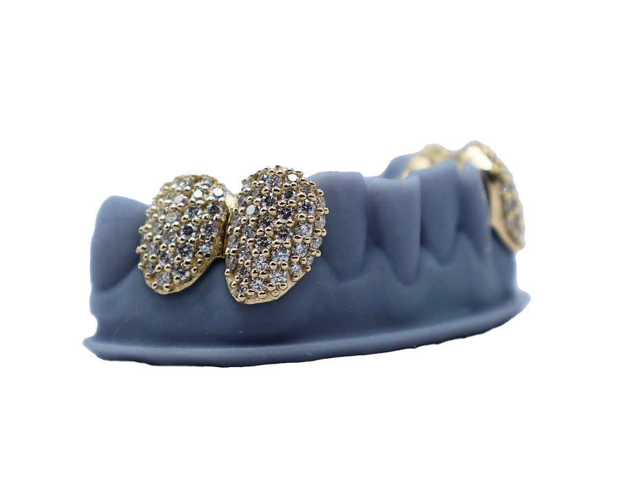 4 Tooth Diamond Grillz Side View