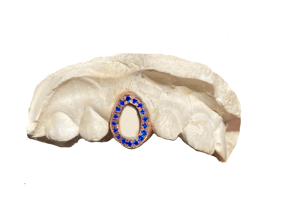 Blue Sapphire Open Face Grillz (14K, Rose Gold)