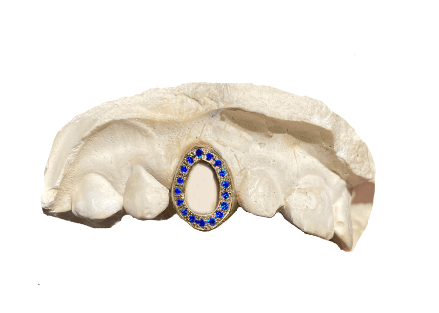 Blue Sapphire Open Face Grillz (14K, Yellow Gold)