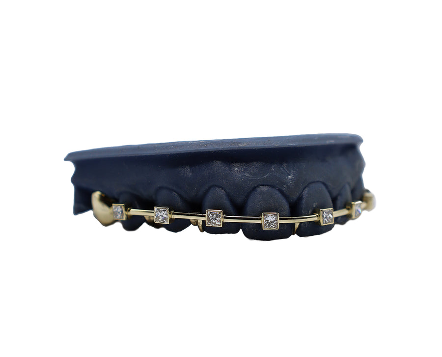 Braces Grillz w Princess Cut Diamonds