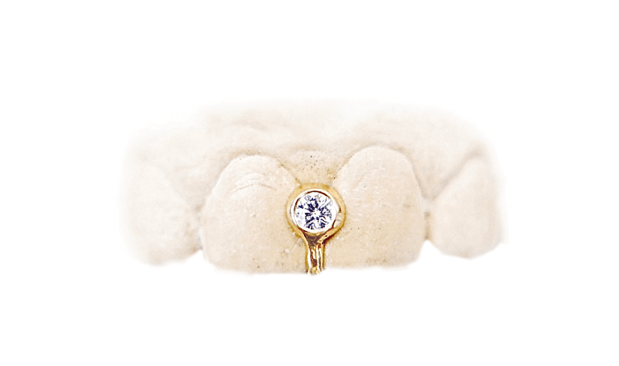 Diamond Bezel-Set Gap Grillz (VS, 14K, Yellow Gold)