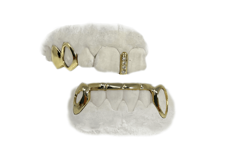 Diamond Gap + Custom Bottom Bridge Grillz Combo (10K, Yellow Gold)