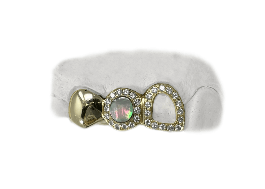 Black Pearl & Diamond Halo Fang w Open Face Diamond Tooth & Solid Gold Molar Grillz (10K, Yellow Gold)