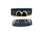 Diamond Bridge Grillz w Opals and Top 4 Grillz w Diamond Tips