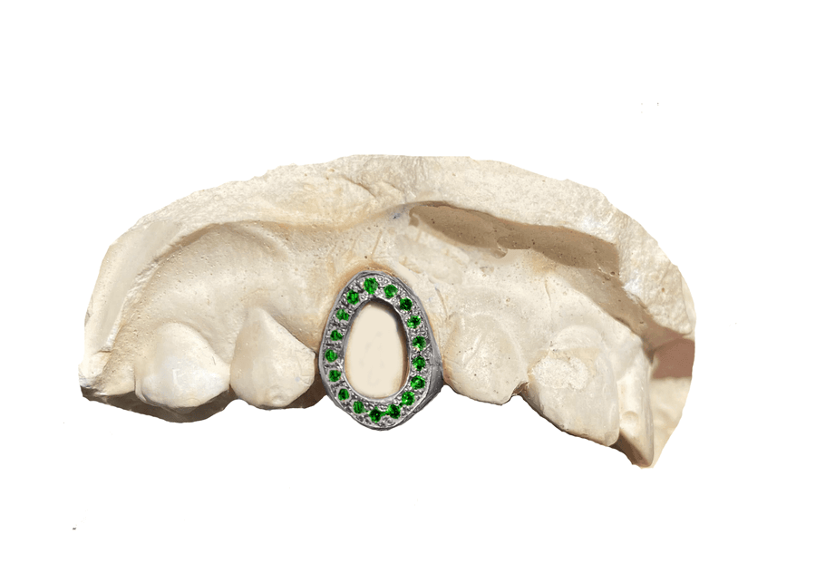 Green Emerald Open Face Grillz (14K, White Gold)