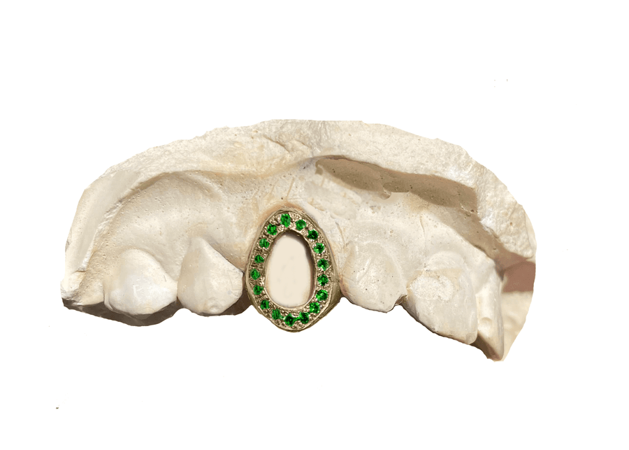 Green Emerald Open Face Grillz (14K, Yellow Gold)