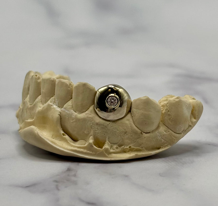 Tooth Bezel Setting Bezel Set Single Stone (One Tooth) – Luxe Grillz
