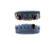 Lapis Grillz w 3D Roses and Baguette Fangs and Black Onyx Tooth