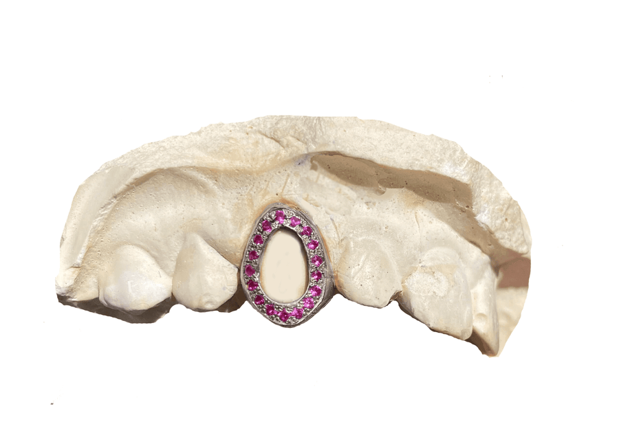 Magenta Sapphire Open Face Grillz (14K, White Gold)