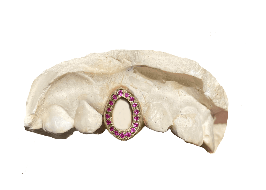 Magenta Sapphire Open Face Grillz (14K, Yellow Gold)