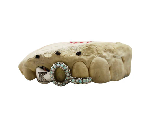 Make Your Mark with Custom Engraved Grillz