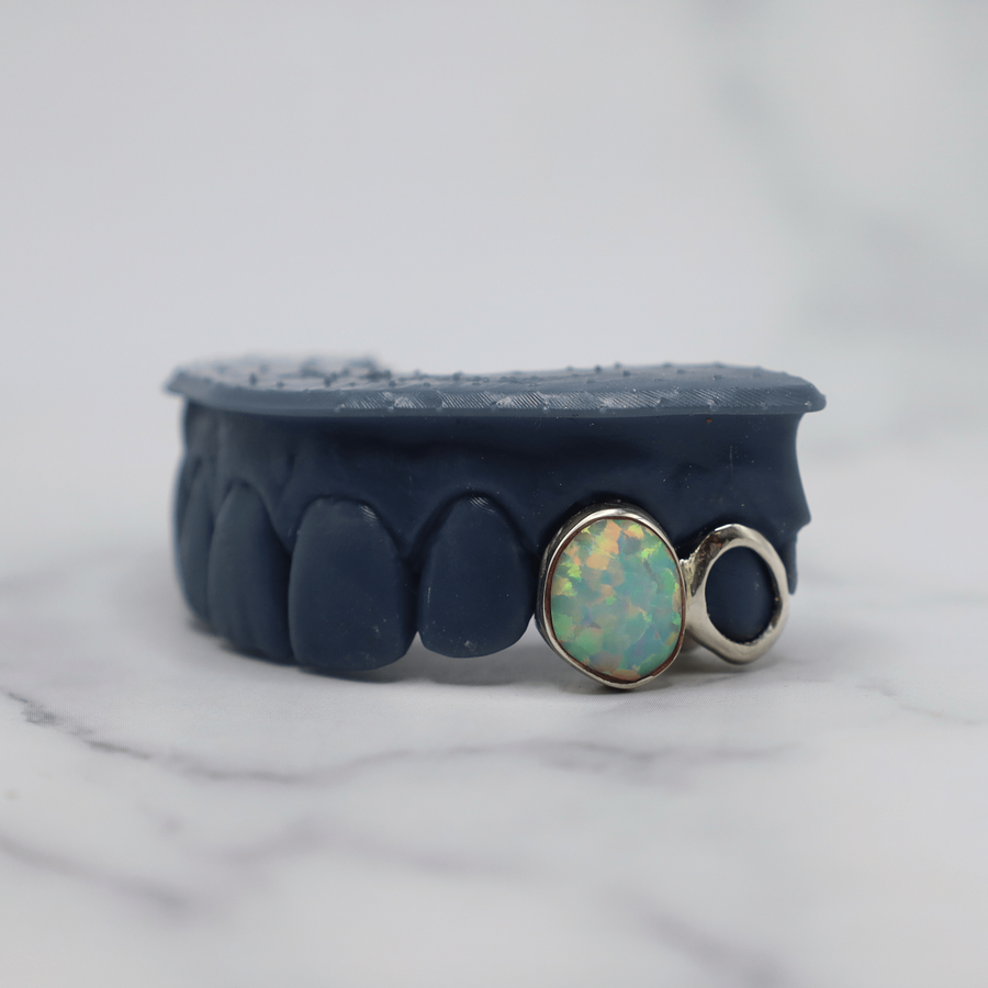 Enamel/Opal (One Tooth)