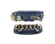 Opal Grillz w Diamond Tip and Rose w Ruby and Diamond Bottom Grillz